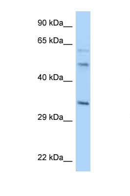 WBSCR22 Antibody (aa200-249)