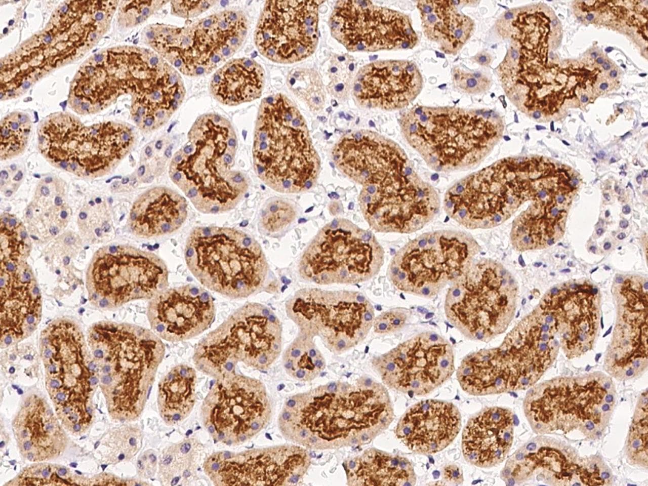 Polyclonal Rabbit anti-Human SNRNP25 Antibody (IHC)