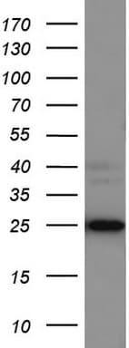 Monoclonal Mouse anti-Human LGALS3 / Galectin 3 Antibody (clone UMAB157, IHC, IF, WB)