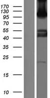 SEMA6C / Semaphorin 6C Protein (Over-Expression Lysate Myc-DDK (Flag))