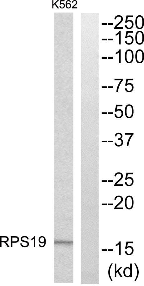 RPS19 / Ribosomal Protein S19 Antibody