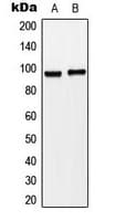 ST14 / Matriptase Antibody (N-Terminus)
