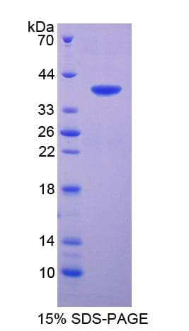 Human SFTPA2 / Surfactant Protein A2 (Recombinant His-GST)