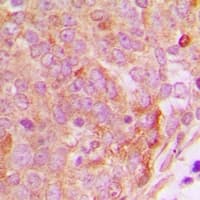 NUTF2 / PP15 Antibody (Internal)