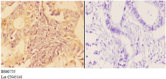 Polyclonal Rabbit anti-Human APOBR / APOB48R Antibody (IHC, WB)