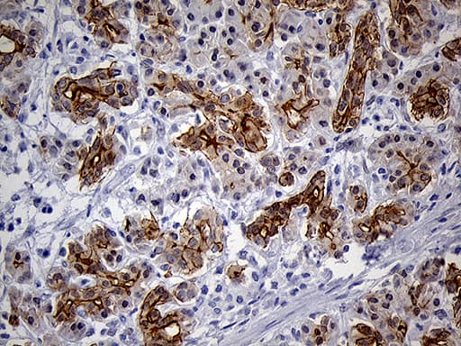 LAD1 Antibody (aa271-517, clone OTI7H8)