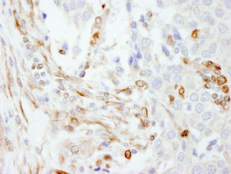 Vimentin Antibody (aa416-466)
