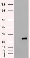 Monoclonal Mouse anti-Human APOM / Apolipoprotein M Antibody (clone OTI3H3, IHC, WB)