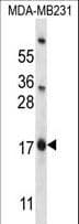 PHLDA2 / TSSC3 Antibody (aa90-119)