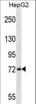 FRMD7 Antibody (aa115-144)