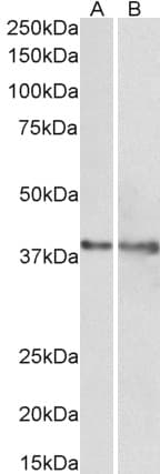 IHC-plus™ IDH3G Antibody (aa337-350)