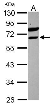 Polyclonal Rabbit anti-Human ETV6 / TEL Antibody (WB)