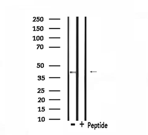 ACKR4 / CCRL1 / CCR11 Antibody