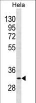 BRMS1 Antibody (aa48-77)