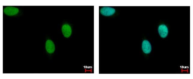 Polyclonal Rabbit anti-Human LIG3 / DNA Ligase III Antibody (aa116-433, IHC, WB)