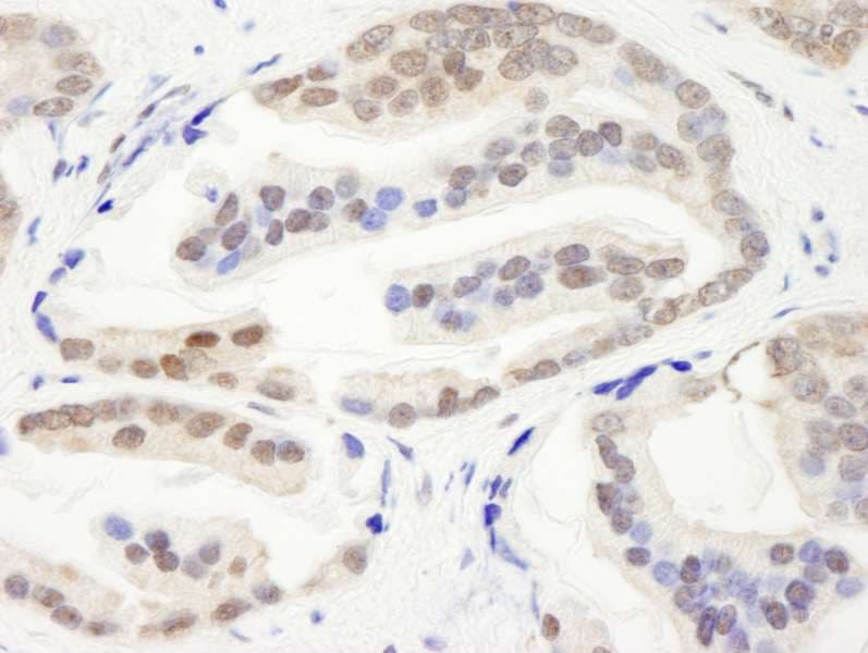 Polyclonal Rabbit anti-Human CHD3 Antibody (aa1950-2000, IHC)