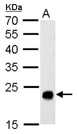 IHC-plus™ GSTT1 Antibody (aa1-240)