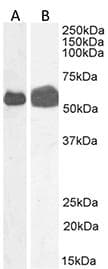 TH / Tyrosine Hydroxylase Antibody