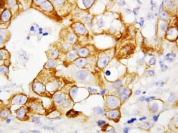 TNFRSF1B / TNFR2 Antibody (aa103-121)