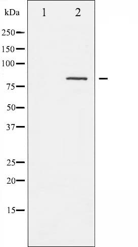 CALD1 / Caldesmon Antibody (phospho-Ser789)