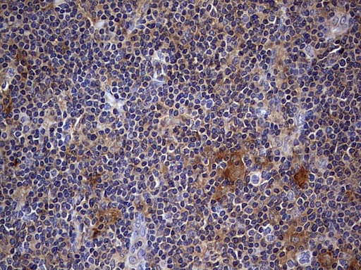 KYNU Antibody (aa1-216, clone OTI1H1)
