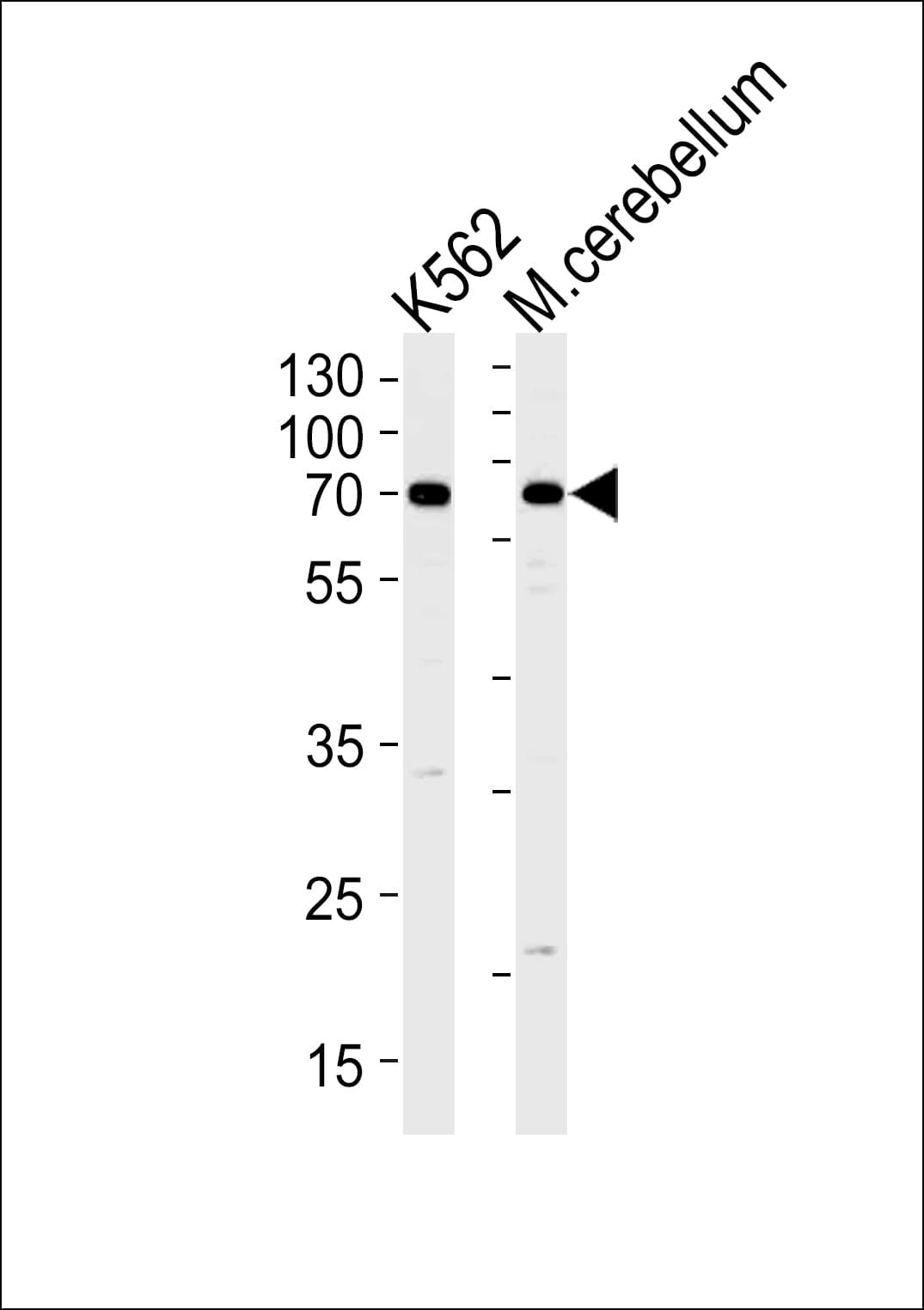 Polyclonal Rabbit anti-Human EPM2AIP1 Antibody (aa39-62, WB)