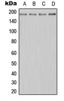 Polyclonal Rabbit anti-Human MER / MERTK Antibody (N-Terminus, WB)