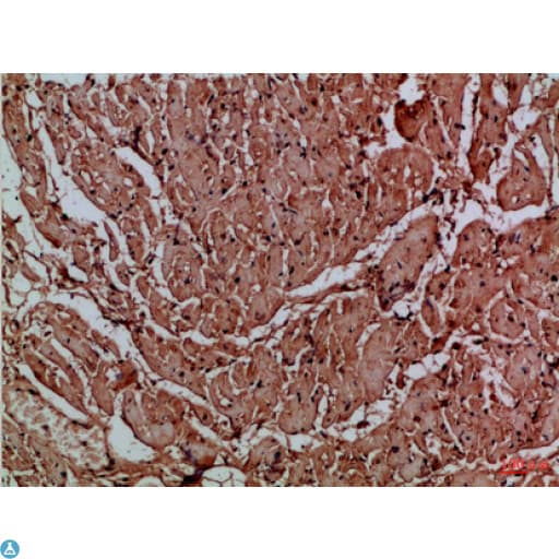 TNRC5 / CNPY3 Antibody