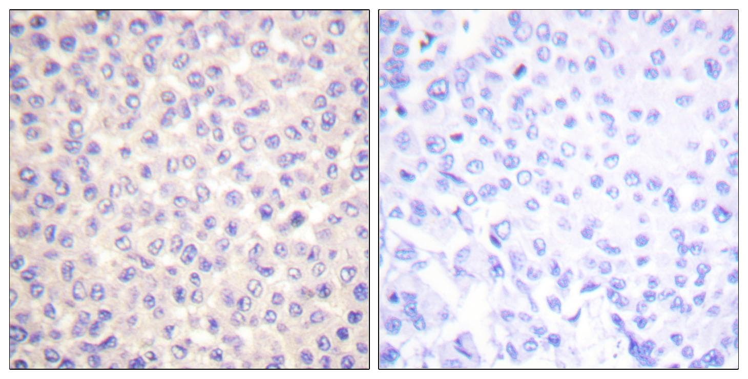 FADD Antibody (phospho-Ser194)