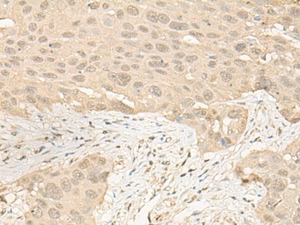 IMPA1 / IMP Antibody