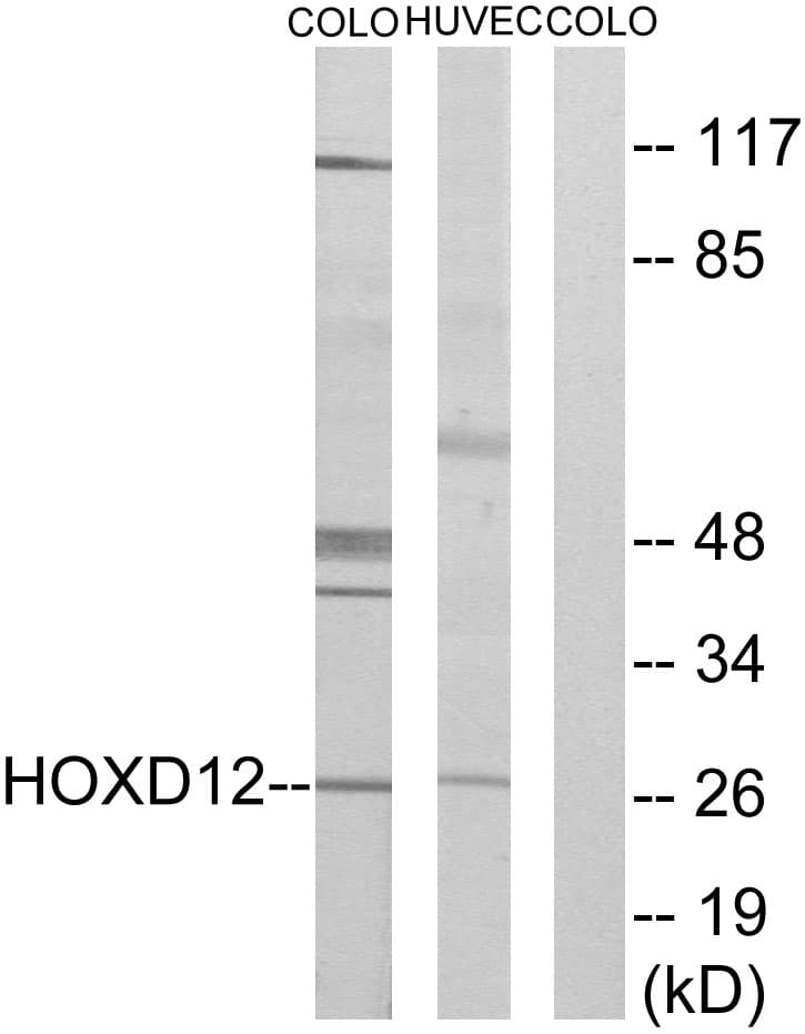 HOXD12 Antibody (aa191-240)
