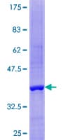 Human DNT / NT5C Protein (Recombinant GST)