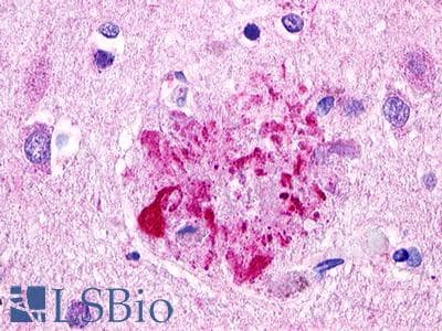 IHC-plus™ Polyclonal Rabbit anti-Human C3AR / C3a Receptor Antibody (C-Terminus, IHC)