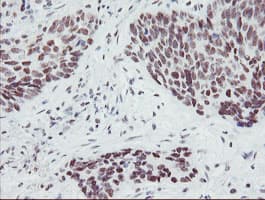 Monoclonal Mouse anti-Human SENP2 Antibody (clone OTI1H2, IHC, IF, WB)