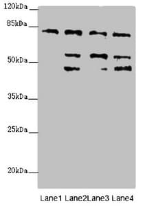 ZFYVE1 / DFCP1 Antibody
