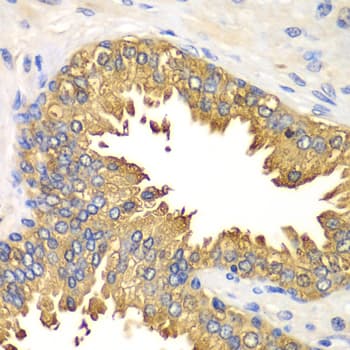 Polyclonal Rabbit anti-Human DDX58 / RIG-1 / RIG-I Antibody (IHC, IF, WB)