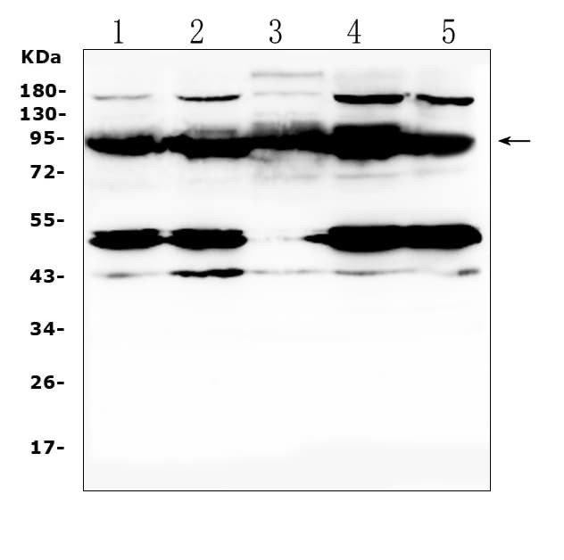 Polyclonal Rabbit anti-Mouse PTPN22 / PEP Antibody (IHC, WB)