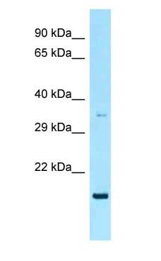 Polyclonal Rabbit anti-Human RAP2 Antibody (aa99-148, WB)