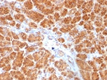 Monoclonal Mouse anti-Human CLTA / LCA Antibody (clone SPM174, IHC, IF, WB)
