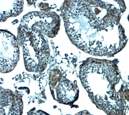 Polyclonal Rabbit anti-Human IZUMO1 / IZUMO Antibody (IHC, WB)
