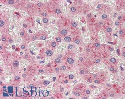 IHC-plus™ Polyclonal Rabbit anti-Human COMMD1 Antibody (IHC, IF, WB)