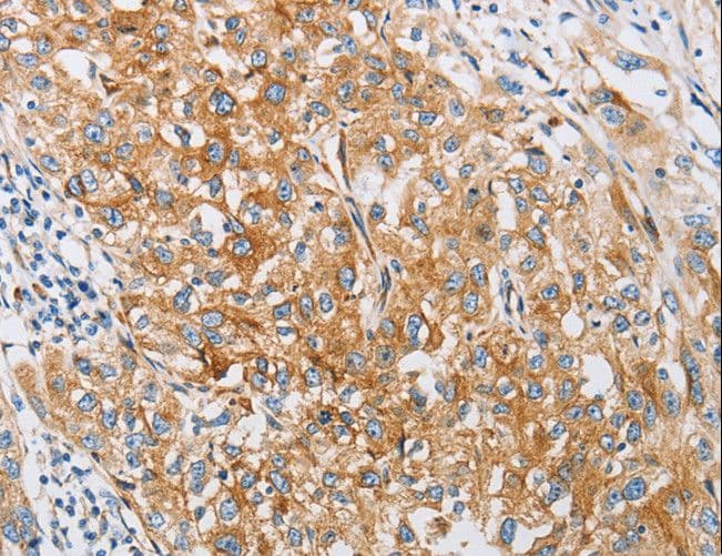 Fragilis / IFITM3 Antibody