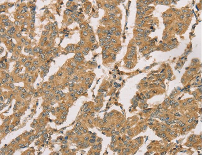 DMRTA3 / DMRT3 Antibody