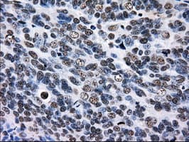 RPA2 / RFA2 / RPA34 Antibody (clone OTI8B3)