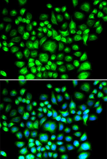 BCAP31 / BAP31 Antibody