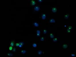 SSX1 Antibody (clone OTI1B5)