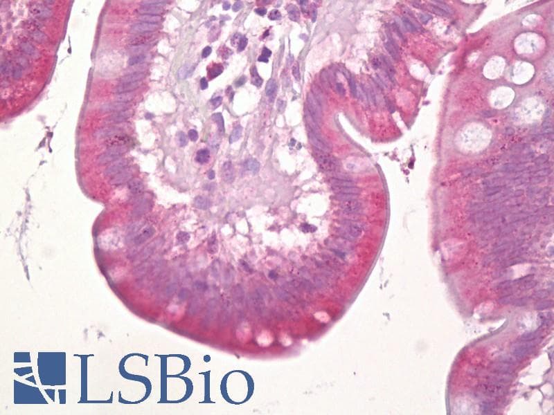 IHC-plus™ Polyclonal Rabbit anti-Human C-TAK1 / MARK3 Antibody (aa1-50, IHC, WB)