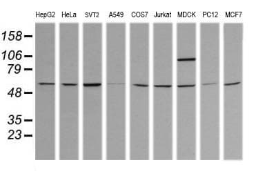 TRIM38 Antibody (clone OTI2G9)