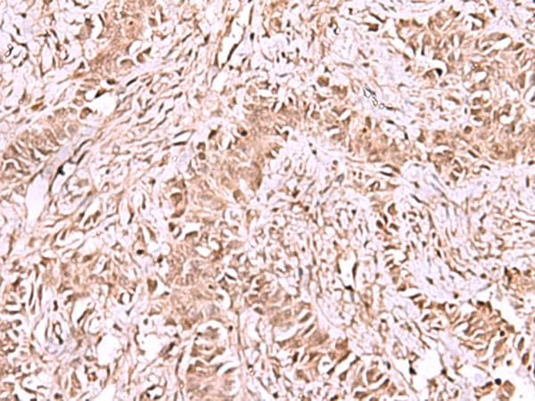 Polyclonal Rabbit anti-Human CDKN1B / p27 Kip1 Antibody (IHC)