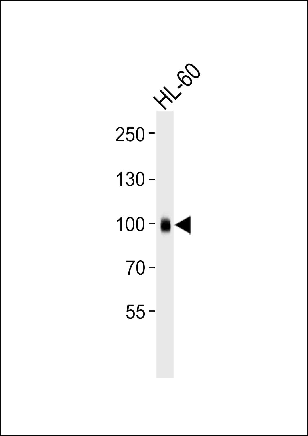 ITGB2 / CD18 Antibody